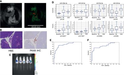 A Translational Model to Improve Early Detection of Epithelial Ovarian Cancers